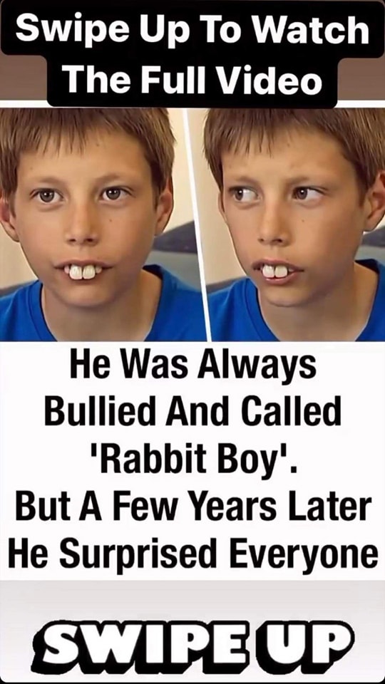 Boy called “rabbit” and bullied for his teeth gets incredible transformation
