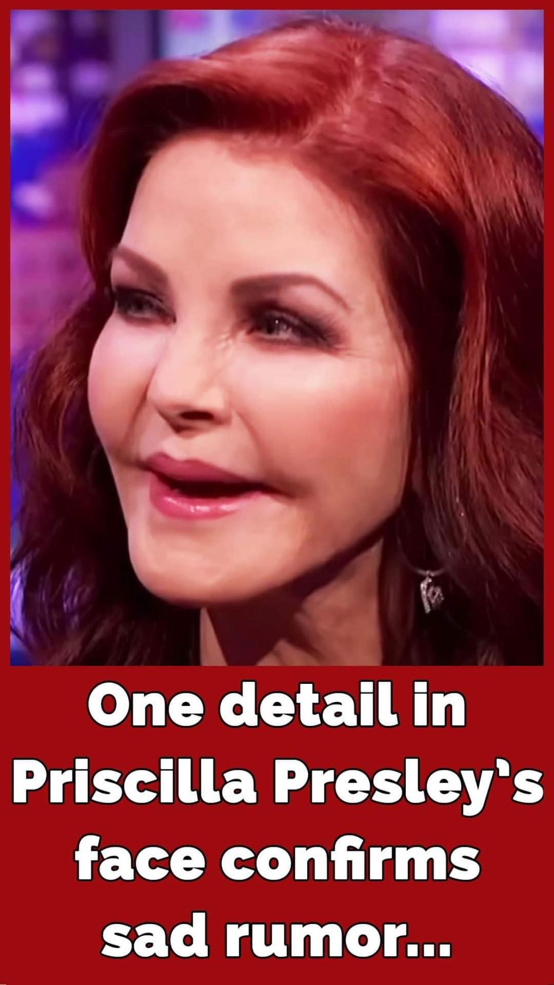 How Priscilla Presley, 77, had plastic surgery procedure gone wrong: Inside her life