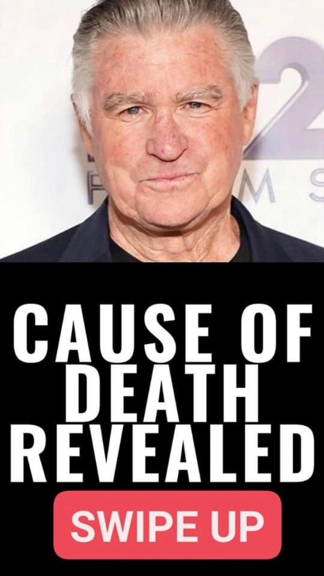 Treat Williams Cause of Death Revealed