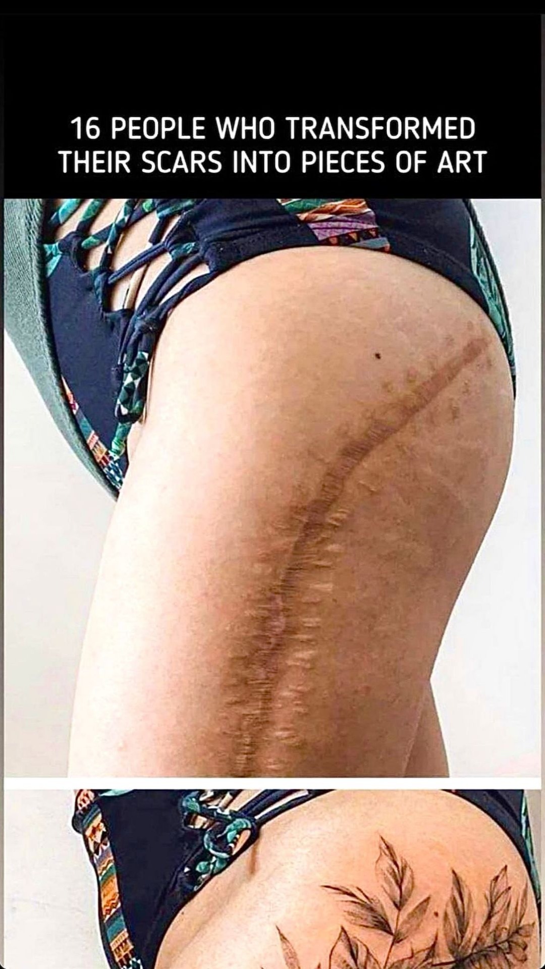 Tattoos that help turn your scars into something beautiful